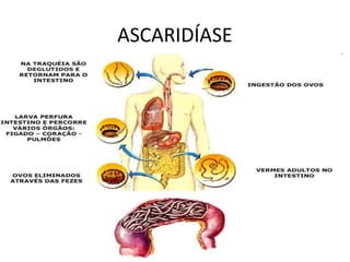 ASCARIDÍASE
 