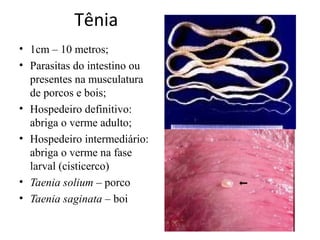 Tênia
• 1cm – 10 metros;
• Parasitas do intestino ou
presentes na musculatura
de porcos e bois;
• Hospedeiro definitivo:
abriga o verme adulto;
• Hospedeiro intermediário:
abriga o verme na fase
larval (cisticerco)
• Taenia solium – porco
• Taenia saginata – boi
 