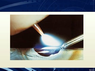 Tecnologia de la unión