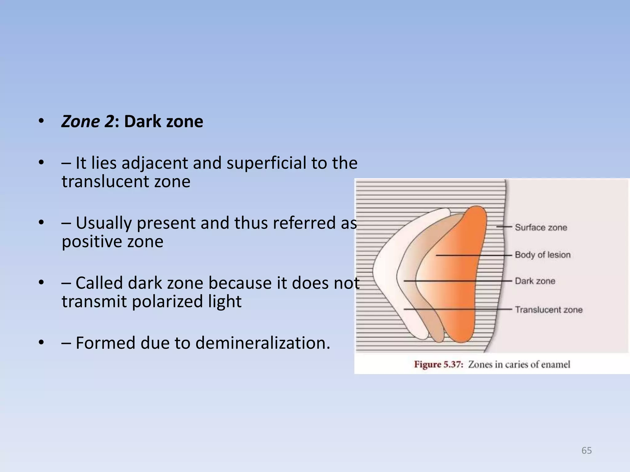 02.dental caries | PPTX