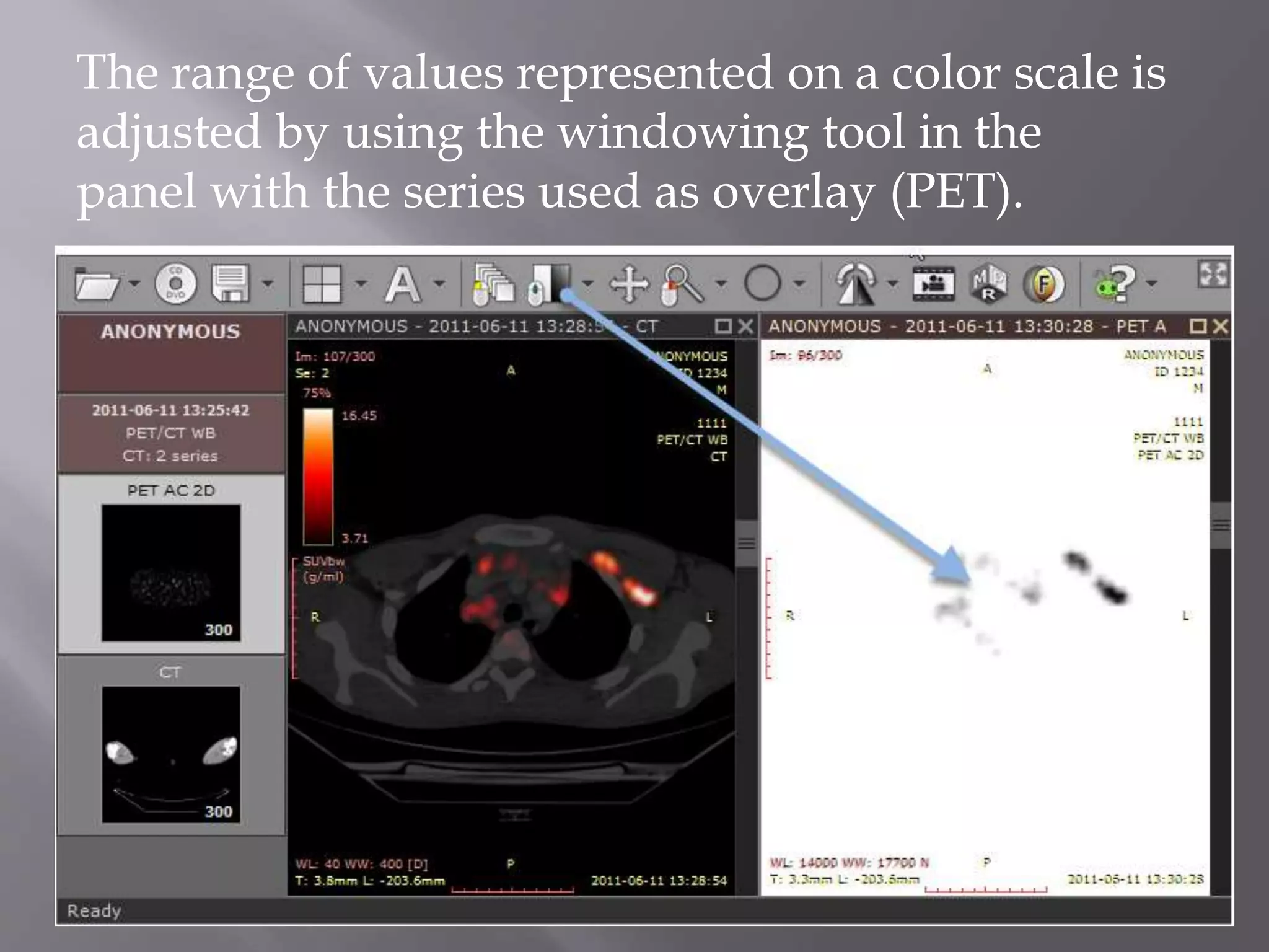 Nuclear Medicine - PET/CT | PPTX