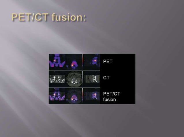 Nuclear Medicine - PET/CT | PPTX | Medical Tests | Medical Health