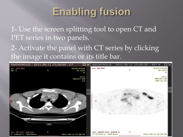 Nuclear Medicine - PET/CT | PPTX | Medical Tests | Medical Health