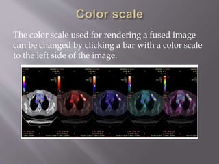 Nuclear Medicine - PET/CT | PPTX