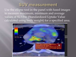Nuclear Medicine - PET/CT | PPTX