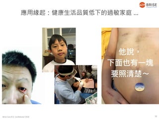 Brise Care B.V. Confidential 2018
應用緣起：健康生活品質低下的過敏家庭 …
10
 