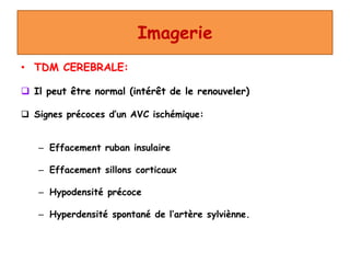 Imagerie
• TDM CEREBRALE:
 Il peut être normal (intérêt de le renouveler)
 Signes précoces d’un AVC ischémique:
– Effacement ruban insulaire
– Effacement sillons corticaux
– Hypodensité précoce
– Hyperdensité spontané de l’artère sylviènne.
 