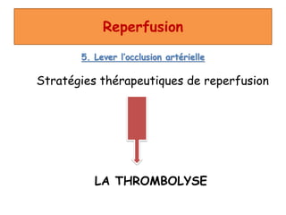Reperfusion
5. Lever l’occlusion artérielle
Stratégies thérapeutiques de reperfusion
LA THROMBOLYSE
 