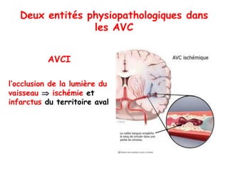 Deux entités physiopathologiques dans
les AVC
AVCI
l’occlusion de la lumière du
vaisseau  ischémie et
infarctus du territoire aval
 