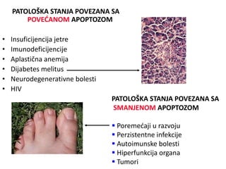 PATOLOŠKA STANJA POVEZANA SA
POVEĆANOM APOPTOZOM
• Insuficijencija jetre
• Imunodeficijencije
• Aplastična anemija
• Dijabetes melitus
• Neurodegenerativne bolesti
• HIV
PATOLOŠKA STANJA POVEZANA SA
SMANJENOM APOPTOZOM
 Poremećaji u razvoju
 Perzistentne infekcije
 Autoimunske bolesti
 Hiperfunkcija organa
 Tumori
 
