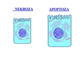 NEKROZA APOPTOZA
 