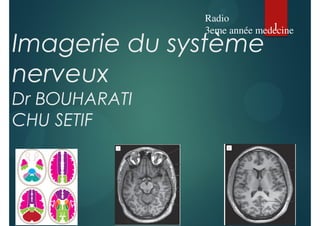 Imagerie du système
nerveux
Dr BOUHARATI
CHU SETIF
1
Radio
3eme année medecine
 