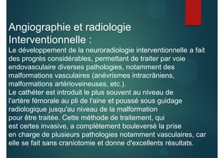 Angiographie et radiologie
Interventionnelle :
Le développement de la neuroradiologie interventionnelle a fait
des progrès considérables, permettant de traiter par voie
endovasculaire diverses pathologies, notamment des
malformations vasculaires (anévrismes intracrâniens,
malformations artérioveineuses, etc.).
Le cathéter est introduit le plus souvent au niveau de
l'artère fémorale au pli de l'aine et poussé sous guidage
radiologique jusqu'au niveau de la malformation
pour être traitée. Cette méthode de traitement, qui
est certes invasive, a complètement bouleversé la prise
en charge de plusieurs pathologies notamment vasculaires, car
elle se fait sans craniotomie et donne d'excellents résultats.
 