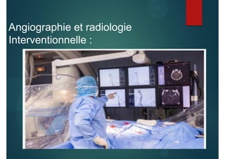 Angiographie et radiologie
Interventionnelle :
 
