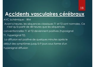 Accidents vasculaires cérébraux
AVC ischémique : IRM
Avant 6 heures, les séquences classiques T1 et T2 sont normales. Ce
n'est qu'à partir de 48 heures que les séquences
conventionnelles T1 et T2 deviennent positives (hyposignal
T1, hypersignal T2).
La diffusion est positive de quelques minutes après le
début des symptômes jusqu'à 9 jours sous forme d'un
hypersignal diffusion
18
 