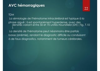 AVC hémorragiques
TDM
La sémiologie de l'hématome intracérébral est typique à la
phase aiguë ; il est spontanément hyperdense, avec des
densités variant entre 50 et 70 unités Hounsfield (UH) ( fig. 7.10
).
La densité de l'hématome peut néanmoins être parfois
basse (anémie), rendant le diagnostic difficile ou conduisant
à de faux diagnostics, notamment de tumeurs cérébrales.
22
 