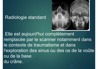 Radiologie standard
Elle est aujourd'hui complètement
remplacée par le scanner notamment dans
le contexte de traumatisme et dans
l'exploration des sinus ou des os de la voûte
ou de la base
du crâne.
 