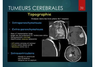 TUMEURS CEREBRALES 31
 