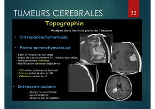 TUMEURS CEREBRALES 32
 