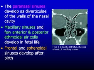 Frontal Sinus Development 02. Development of Face.ppt