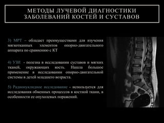 3) МРТ – обладает преимуществами для изучения
мягкотканных элементов опорно-двигательного
аппарата по сравнению с КТ
4) УЗИ - полезна в исследовании суставов и мягких
тканей, окружающих кость. Нашла большое
применение в исследовании опорно-двигательной
системы в детей младшего возраста.
5) Радионуклидное исследование - используется для
исследования обменных процессов в костной ткани, в
особенности ее опухолевых поражений.
МЕТОДЫ ЛУЧЕВОЙ ДИАГНОСТИКИ
ЗАБОЛЕВАНИЙ КОСТЕЙ И СУСТАВОВ
 
