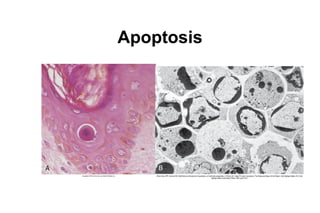 The cellular basis of disease cell injury apoptosis and necrosis | PDF
