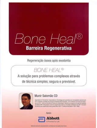 Conheça a técnica Bone Heal