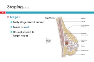 Staging….
 Stage I
 Early stage breast cancer
 Tumor is small
 Has not spread to
lymph nodes
23
 