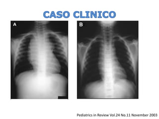 2 
Pediatrics in Review Vol.24 No.11 November 2003 
2  