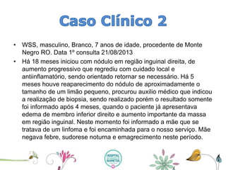 •WSS, masculino, Branco, 7 anos de idade, procedente de Monte Negro RO. Data 1º consulta 21/08/2013 
•Há 18 meses iniciou com nódulo em região inguinal direita, de aumento progressivo que regrediu com cuidado local e antiinflamatório, sendo orientado retornar se necessário. Há 5 meses houve reaparecimento do nódulo de aproximadamente o tamanho de um limão pequeno, procurou auxilio médico que indicou a realização de biopsia, sendo realizado porém o resultado somente foi informado após 4 meses, quando o paciente já apresentava edema de membro inferior direito e aumento importante da massa em região inguinal. Neste momento foi informado a mãe que se tratava de um linfoma e foi encaminhada para o nosso serviço. Mãe negava febre, sudorese noturna e emagrecimento neste período.  
