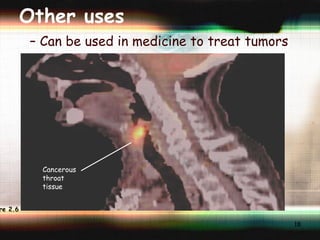 Other uses Can be used in medicine to treat tumors Cancerous throat tissue Figure 2.6 