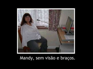 Mandy, sem visão e braços. 