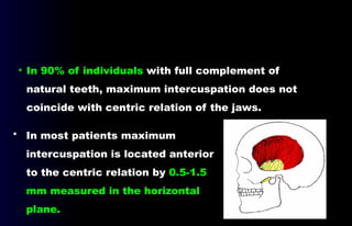 02- Definitions (Occlusion in prosthodontics) .pptx