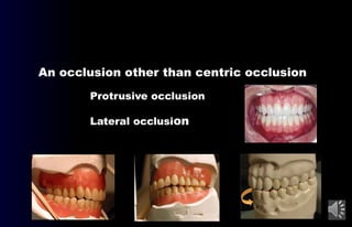 Proclusive 02- Definitions (Occlusion in prosthodontics) .pptx