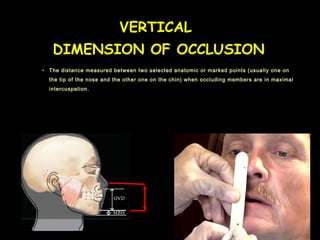 VERTICAL
DIMENSION OF OCCLUSION
• The distance measured between two selected anatomic or marked points (usually one on
the tip of the nose and the other one on the chin) when occluding members are in maximal
intercuspation.
 