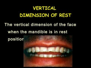 The vertical dimension of the face
when the mandible is in rest
position.
VERTICAL
DIMENSION OF REST
 