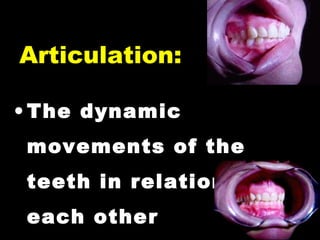 • The dynamic
movements of the
teeth in relation to
each other
Articulation:
 