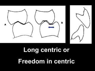 Long centric or
Freedom in centric
 