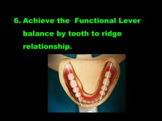 6. Achieve the Functional Lever
balance by tooth to ridge
relationship.
 