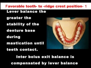 The better the
Lever balance the
greater the
stability of the
denture base
during
mastication until
teeth contact.
1-Favorable tooth- to -ridge crest position
Inter bolus exit balance is
compensated by lever balance
 