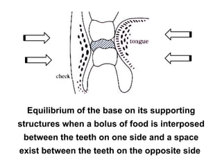 Equilibrium of the base on its supporting
structures when a bolus of food is interposed
between the teeth on one side and a space
exist between the teeth on the opposite side
 