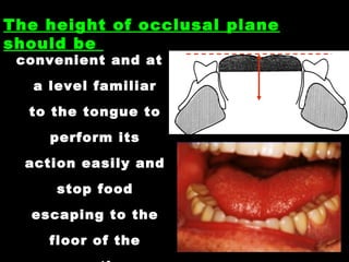 convenient and at
a level familiar
to the tongue to
perform its
action easily and
stop food
escaping to the
floor of the
The height of occlusal plane
should be
 