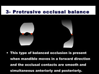 3- Protrusive occlusal balance
• This type of balanced occlusion is present
when mandible moves in a forward direction
and the occlusal contacts are smooth and
simultaneous anteriorly and posteriorly.
 
