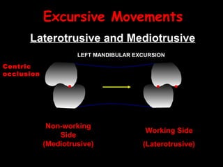 Excursive Movements
Laterotrusive and Mediotrusive
Non-working
Side
(Mediotrusive)
Working Side
(Laterotrusive)
LEFT MANDIBULAR EXCURSION
Centric
occlusion
 