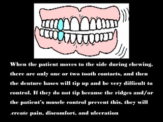 When the patient moves to the side during chewing,
there are only one or two tooth contacts, and then
the denture bases will tip up and be very difficult to
control. If they do not tip because the ridges and/or
the patient’s muscle control prevent this, they will
create pain, discomfort, and ulceration.
 