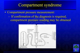 Compartmental Testing ortho 02 orthopaedic complication & prevention + orthopaedic trauma ...