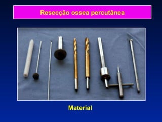 Material  Resecção ossea percutânea 