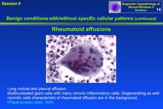 Benign conditions with/without specific cellular patterns  (continued) Session II Rheumatoid effusions Lung nodule and pleural effusion.  Multinucleated giant cells with many chronic inflammatory cells. Degenerating as well necrotic cells characteristic of rheumatoid effusion are in the background.  (Papanicolaou stain, 40X) 14 