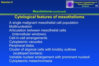 Mesothelioma  (continued) A single malignant mesothelial cell population  Multinucleation  Articulation between mesothelial cells  (intercellular windows) Cell-in-cell arrangements Cytoplasmic vacuoles Peripheral blebs Cluster of atypical cells with knobby outlines  (scalloped borders) Variable nuclear enlargement with prominent nucleoli  Cytoplasmic metachromasia Cytological features of mesothelioma 18 