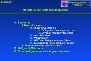 A. Sarcomas I. Blue cell tumors Ia.  Rhabdomyosarcoma ai.   Embryonal rhabdomyosarcoma aii.   Alveolar rhabdomyosarcoma Ib.  Neuroblastoma Ic.  Wilms’ tumor Id.  PNET and Ewing’s sarcoma (EWS) Ie.  Desmoplastic round cell tumor (DSRCT) II. Fibrosarcoma and other sarcomas   B. Malignant Melanoma C. Other malignancies  such as  germ cell tumors Metastatic non-epithelial neoplasms 52 